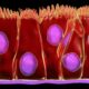 Cellule Epiteliali nelle Urine